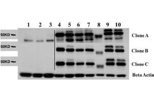 Western Blot of Rat Anti-AKT2 antibody. (V-Akt Murine Thymoma Viral Oncogene Homolog 2 (AKT2) Peptid)