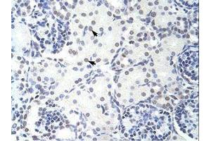 Image no. 1 for anti-Glucocorticoid Modulatory Element Binding Protein 2 (GMEB2) (C-Term) antibody (ABIN202723) (GMEB2 Antikörper  (C-Term))