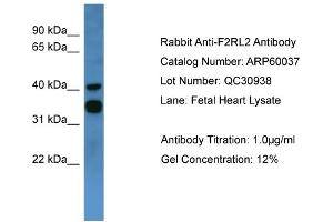 WB Suggested Anti-F2RL2  Antibody Titration: 0. (F2RL2 Antikörper  (C-Term))