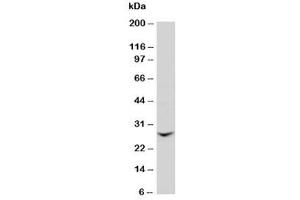 Western blot testing of GJB2 antibody and rat liver tissue lysate (GJB2 Antikörper  (N-Term))