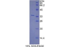 SDS-PAGE analysis of Rat MYH3 Protein. (MYH3 Protein)