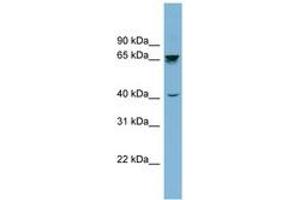 Image no. 1 for anti-Acetylcholinesterase (AChE) (AA 359-408) antibody (ABIN6741992) (Acetylcholinesterase Antikörper  (AA 359-408))