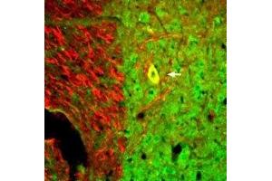 Expression of Neurotrophin 3 in mouse spinal cord - Immunohistochemical staining of perfusion-fixed frozen mouse spinal cord sections with Anti-Neurotrophin 3 (NT-3) Antibody (ABIN7043392, ABIN7044748 and ABIN7044749), (1:300), followed by goat-anti-rabbit-AlexaFluor-488 (green). (Neurotrophin 3 Antikörper  (Intracellular))