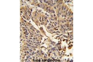 Immunohistochemistry (IHC) image for anti-Junction Plakoglobin (JUP) antibody (ABIN3003996)