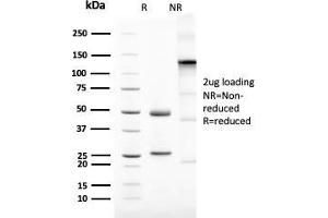 SDS-PAGE Analysis Purified Mammaglobin Recombinant Rabbit Monoclonal (MGB1/2123R). (Rekombinanter Mammaglobin A Antikörper)