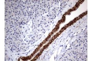 Image no. 1 for anti-Tuberous Sclerosis 1 (TSC1) (AA 836-1164) antibody (ABIN1491685) (TSC1 Antikörper  (AA 836-1164))