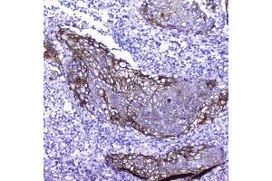 IHC analysis of Periplakin using anti-Periplakin antibody (ABIN5518787). (PPL Antikörper  (C-Term))