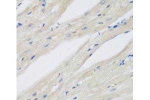Immunohistochemistry (Paraffin-embedded Sections) (IHC (p)) image for anti-N(alpha)-Acetyltransferase 50, NatE Catalytic Subunit (NAA50) antibody (ABIN7261175)