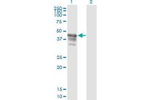 Western Blot analysis of PAIP1 expression in transfected 293T cell line by PAIP1 monoclonal antibody (M04A), clone 2D11.