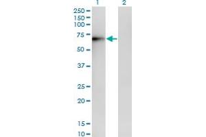 Western Blotting (WB) image for anti-ERO1-Like Protein alpha (ERO1L) (AA 90-179) antibody (ABIN599232) (ERO1L Antikörper  (AA 90-179))