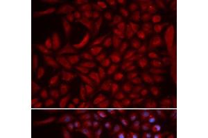 Immunofluorescence analysis of U2OS cells using CUL5 Polyclonal Antibody (Cullin 5 Antikörper)