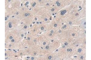 Immunohistochemistry (IHC) image for anti-Matrix Metallopeptidase 19 (MMP19) (AA 98-508) antibody (ABIN7434200)