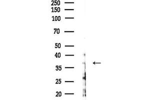 anti-Ras-Related GTP Binding A/B (RRAGA/B) antibody