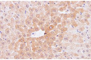 Immunohistochemistry of paraffin-embedded Mouse liver using IL2 Polyclonal Antibody at dilution of 1:100 (IL-2 Antikörper)