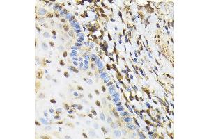 Immunohistochemistry (IHC) image for anti-Nuclear Receptor Binding Factor 2 (NRBF2) (AA 10-220) antibody (ABIN6144842)
