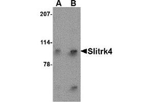 Western Blotting (WB) image for anti-SLIT and NTRK-Like Family, Member 4 (SLITRK4) (N-Term) antibody (ABIN1031578)