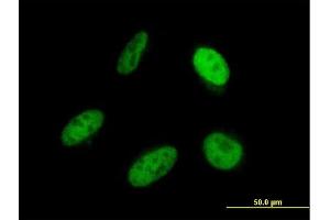 Immunofluorescence of monoclonal antibody to SRP68 on HeLa cell. (SRP68 Antikörper  (AA 531-627))