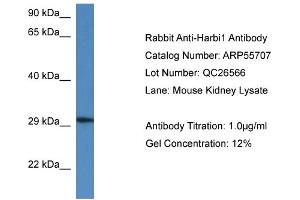 Western Blotting (WB) image for anti-Harbinger Transposase Derived 1 (HARBI1) (N-Term) antibody (ABIN2786327) (HARBI1 Antikörper  (N-Term))