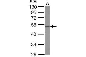Western Blotting (WB) image for anti-Corticotropin Releasing Hormone Receptor 1 (CRHR1) (N-Term) antibody (ABIN2854642)