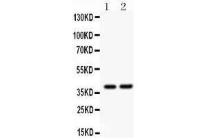 Western Blotting (WB) image for anti-SRY (Sex Determining Region Y)-Box 1 (SOX1) (AA 215-248), (Middle Region) antibody (ABIN3043439) (SOX1 Antikörper  (Middle Region))