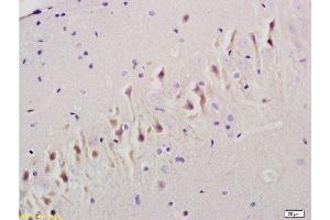 Immunohistochemistry (Paraffin-embedded Sections) (IHC (p)) image for anti-TGF beta Receptor 1 (AA 301-400) antibody (ABIN671256)