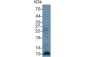 Detection of S100A12 in Human Leukocyte lysate using Polyclonal Antibody to S100 Calcium Binding Protein A12 (S100A12) (S100A12 Antikörper  (AA 1-92))