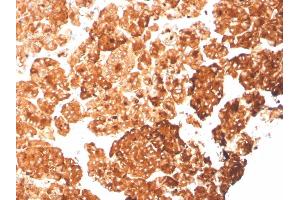 Formalin-fixed, paraffin-embedded human pancreas stained with KRT6A Recombinant Mouse Monoclonal Antibody (rKRT6A/2100). (Rekombinanter KRT6A Antikörper)