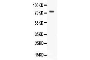 Anti- RIP antibody, Western blottingAll lanes: Anti RIP  at 0.