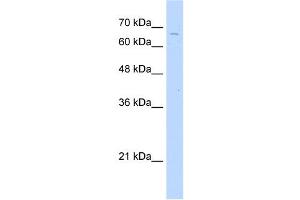 TKTL2 antibody used at 2. (TKTL2 Antikörper  (C-Term))