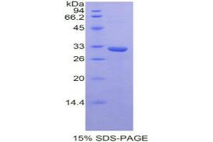 SDS-PAGE analysis of Mouse STAM Binding Protein. (STAMBP Protein)