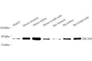 Western blot analysis of TBCD5 (ABIN7075848) at dilution of 1: 2000