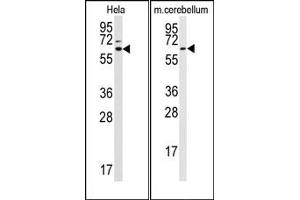 Image no. 1 for anti-Stress-Induced-phosphoprotein 1 (STIP1) (C-Term) antibody (ABIN357984) (STIP1 Antikörper  (C-Term))