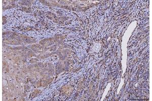 IHC analysis of HLA-DRA using anti-HLA-DRA antibody (ABIN7600949). (HLA-DRA Antikörper  (AA 26-254))