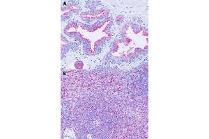 Immunohistochemical staining of formalin-fixed paraffin-embedded human prostate (A) and human spleen (B) with GPR63 polyclonal antibody . (GPR63 Antikörper  (Extracellular Domain))