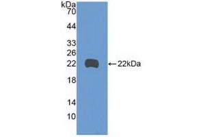 Western blot analysis of recombinant Human GADD45b. (GADD45B Antikörper  (AA 1-160))