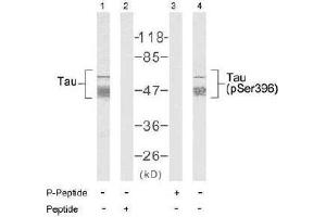 Image no. 2 for anti-Microtubule-Associated Protein tau (MAPT) (Ser396) antibody (ABIN197257) (MAPT Antikörper  (Ser396))