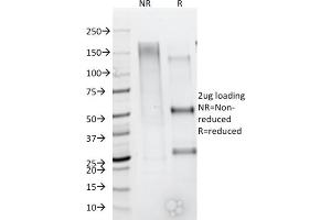 SDS-PAGE Analysis Purified CD79b Mouse Monoclonal Antibody (IGB/1844). (CD79b Antikörper  (AA 29-159))