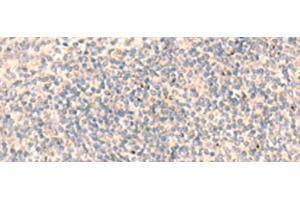 Immunohistochemistry (Paraffin-embedded Sections) (IHC (p)) image for anti-ADAM Metallopeptidase with Thrombospondin Type 1 Motif, 2 (Adamts2) antibody (ABIN7248080)