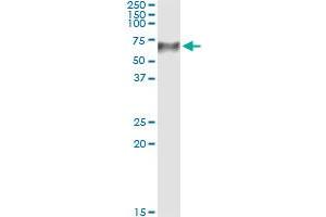 Western Blotting (WB) image for anti-Transcobalamin I (Vitamin B12 Binding Protein, R Binder Family) (TCN1) (AA 1-423) antibody (ABIN520794)