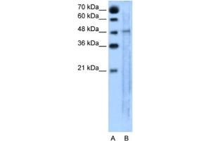 Western Blotting (WB) image for anti-Solute Carrier Family 25, Member 46 (SLC25A46) antibody (ABIN2462775)