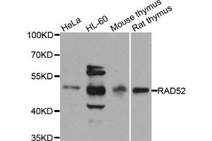 Western blot analysis of extracts of various cell lines, using RAD52 antibody. (RAD52 Antikörper  (AA 125-418))