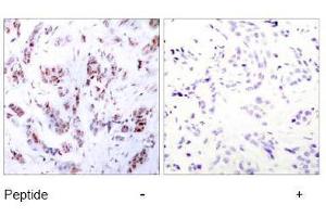 Image no. 2 for anti-Myocyte Enhancer Factor 2A (MEF2A) (Thr312) antibody (ABIN197165) (MEF2A Antikörper  (Thr312))