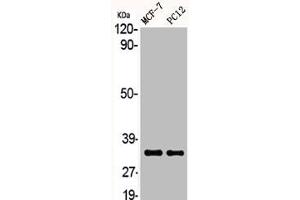 Western Blot analysis of MCF7 PC-12 cells using ACOT8 Polyclonal Antibody (ACOT8 Antikörper  (Internal Region))