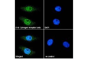 ABIN5539801 Immunofluorescence analysis of paraformaldehyde fixed HeLa cells, permeabilized with 0. (ESR2 Antikörper  (AA 417-428))