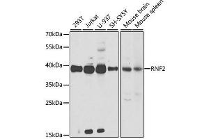 Western blot analysis of extracts of various cell lines, using RNF2 antibody. (RNF2 Antikörper  (AA 1-336))