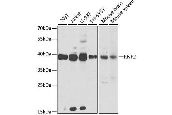 RNF2 Antikörper  (AA 1-336)