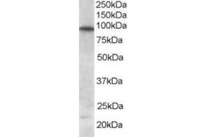 Image no. 1 for anti-Forkhead Box O3 (FOXO3) (C-Term) antibody (ABIN374440) (FOXO3 Antikörper  (C-Term))