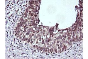 Image no. 1 for anti-Cancer/testis Antigen 1B (CTAG1B) antibody (ABIN1499894) (CTAG1B Antikörper)