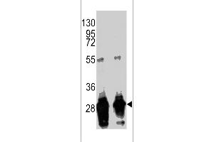 Western blot analysis of anti-GFP Tag Antibody (Ascites) (CA071114E) in GFP recombinant protein. (GFP Tag Antikörper)