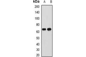 Western blot analysis of CTNNBL1 expression in Hela (A), SW620 (B) whole cell lysates.